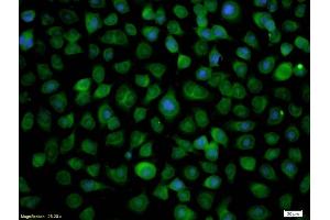 Formalin-fixed and paraffin-embedded human oral squamous cell labeled with Anti-RASSF1A Polyclonal Antibody, Unconjugated (ABIN673764) 1:200, overnight at 4°C, The secondary antibody was Goat Anti-Rabbit IgG, FITC conjugated used at 1:200 dilution for 40 minutes at 37°C.