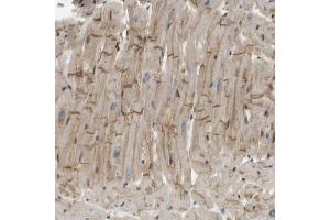 Immunohistochemical staining (Formalin-fixed paraffin-embedded sections) of human heart muscle with TSPAN9 polyclonal antibody  shows moderate positivity in intercalated discs. (Tetraspanin 9 anticorps  (AA 123-200))