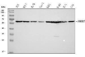 Western blot analysis of AMHR2 using anti-AMHR2 antibody (ABIN4886456).
