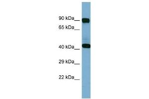 Western Blotting (WB) image for anti-Isovaleryl-CoA Dehydrogenase (IVD) (N-Term) antibody (ABIN2787703) (IVD anticorps  (N-Term))