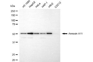 anti-Annexin A11 (ANXA11) antibody