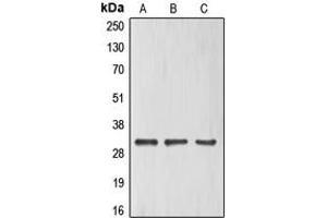 Western blot analysis of ELF5 expression in HeLa (A), HuvEc (B), Jurkat (C) whole cell lysates. (ELF5 anticorps  (C-Term))