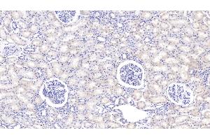 Detection of PIGR in Bovine Kidney Tissue using Polyclonal Antibody to Polymeric Immunoglobulin Receptor (PIGR) (PIGR anticorps  (AA 250-341))