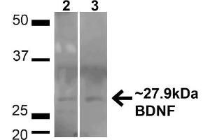Western blot analysis of Human HeLa and HEK293T cell lysates showing detection of ~27. (BDNF anticorps  (N-Term) (Atto 594))