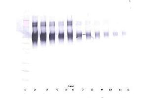 Image no. 1 for anti-Intercellular Adhesion Molecule 1 (ICAM1) antibody (ABIN465661) (ICAM1 anticorps)