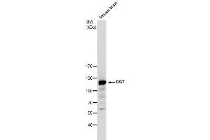 WB Image O-GlcNAc transferase antibody detects O-GlcNAc transferase protein by western blot analysis.
