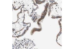 Immunohistochemical staining of human placenta with TMF1 polyclonal antibody  shows strong cytoplasmic positivity with granular pattern in trophoblastic cells at 1:200-1:500 dilution. (TMF1 anticorps)