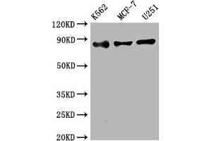 Western Blot Positive WB detected in: K562 whole cell lysate, MCF-7 whole cell lysate, U251 whole cell lysate All lanes: IKK beta antibody at 1:2000 Secondary Goat polyclonal to rabbit IgG at 1/50000 dilution Predicted band size: 87 kDa Observed band size: 87 kDa