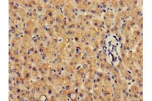 Immunohistochemistry of paraffin-embedded human liver tissue using ABIN7154093 at dilution of 1:100 (GSTA4 anticorps  (AA 1-222))