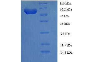 SDS-PAGE (SDS) image for Serine/threonine-Protein Kinase NIM1 (NIM1) (AA 1-436), (full length) protein (His-SUMO Tag) (ABIN5711507)
