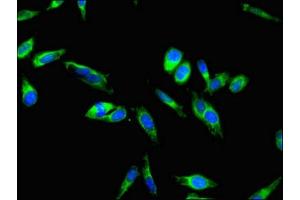 Immunofluorescent analysis of Hela cells using ABIN7147989 at dilution of 1:100 and Alexa Fluor 488-congugated AffiniPure Goat Anti-Rabbit IgG(H+L)