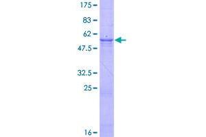 Image no. 1 for Deoxyribonuclease I (DNASE1) (AA 1-282) protein (GST tag) (ABIN1351834)