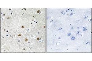 Immunohistochemistry analysis of paraffin-embedded human brain tissue, using TF3B Antibody. (BRF1 anticorps  (AA 231-280))
