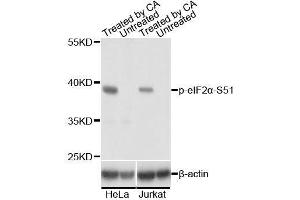 Western blot analysis of extracts of HeLa and Jurkat cells,using Phospho-eIF2α-S51 antibody. (EIF2S1 anticorps  (pSer51))