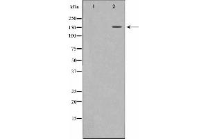 Western blot analysis on 293 cell lysate using MRC2 Antibody,The lane on the left is treated with the antigen-specific peptide. (MRC2 anticorps  (N-Term))