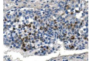 IHC analysis of TMPRSS3 using anti-TMPRSS3 antibody (ABIN7601198). (TMPRSS3 anticorps  (AA 3-454))