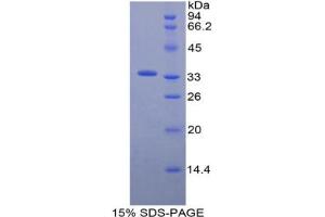 SDS-PAGE analysis of Mouse ECE1 Protein. (ECE1 Protéine)