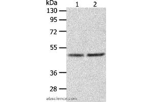 Western blot analysis of Human fetal liver tissue and hepg2 cell, using AGXT Polyclonal Antibody at dilution of 1:1050 (AGXT anticorps)