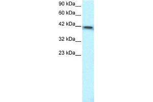 WB Suggested Anti-ERCC8 Antibody Titration:  0.