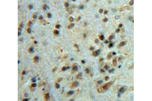 Used in DAB staining on fromalin fixed paraffin-embedded Brain tissue (Ataxin 1 anticorps  (AA 331-587))