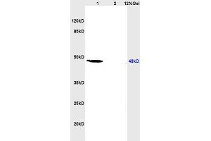 L1 human colon carcinoma lysates L2 rat heart lysates probed with Anti IL-2R gamma/CD132 Polyclonal Antibody, Unconjugated (ABIN669516) at 1:200 overnight at 4 °C.