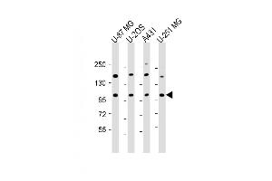 All lanes : Anti-THSD1 Antibody (C-Term) at 1:2000 dilution Lane 1: U-87 MG whole cell lysate Lane 2: U-2OS whole cell lysate Lane 3: A431 whole cell lysate Lane 4: U-251 MG whole cell lysate Lysates/proteins at 20 μg per lane.