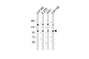 All lanes : Anti-THSD1 Antibody (C-Term) at 1:2000 dilution Lane 1: U-87 MG whole cell lysate Lane 2: U-2OS whole cell lysate Lane 3: A431 whole cell lysate Lane 4: U-251 MG whole cell lysate Lysates/proteins at 20 μg per lane. (THSD1 anticorps  (AA 668-699))