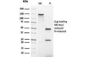 SDS-PAGE Analysis Purified IgG4 Mouse Recombinant Monoclonal Antibody (rIGHG4/1345). (Recombinant IGHG4 anticorps)
