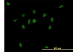 Immunofluorescence of monoclonal antibody to CSE1L on HeLa cell. (Exportin 2 anticorps  (AA 872-971))