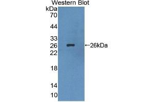 Detection of Recombinant LIM2, Human using Polyclonal Antibody to Lens Intrinsic Membrane Protein 2 (LIM2) (LIM2 anticorps  (AA 30-136))