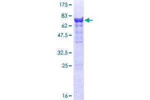 Image no. 1 for Proteasome (Prosome, Macropain) 26S Subunit, ATPase, 3 (PSMC3) (AA 1-439) protein (GST tag) (ABIN1316601)