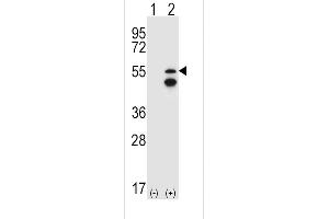 Western blot analysis of FRK (arrow) using rabbit polyclonal FRK Antibody (V28) (ABIN392097 and ABIN2841849). (FRK anticorps  (N-Term))