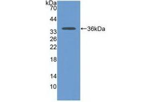 Detection of Recombinant CDH17, Human using Polyclonal Antibody to Cadherin 17 (CDH17)