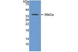 Detection of Recombinant CDH17, Human using Polyclonal Antibody to Cadherin 17 (CDH17) (LI Cadherin anticorps  (AA 67-351))