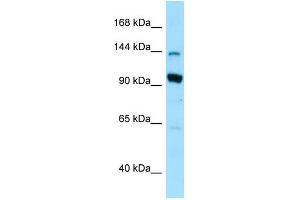 WB Suggested Anti-USO1 Antibody Titration: 1. (USO1 anticorps  (N-Term))