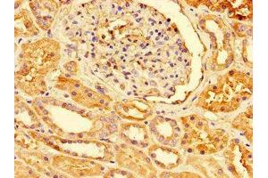 Immunohistochemistry of paraffin-embedded human kidney tissue using ABIN7172023 at dilution of 1:100