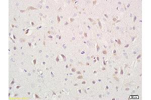 Formalin-fixed and paraffin embedded rat brain labeled with Anti- CD171/NCAM-L1 Polyclonal Antibody, Unconjugated (ABIN676463) at 1:400 followed by conjugation to the secondary antibody and DAB staining (L1CAM anticorps  (AA 1101-1257))
