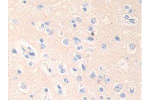 Detection of EPN1 in Human Cerebrum Tissue using Polyclonal Antibody to Epsin 1 (EPN1) (Epsin 1 anticorps  (AA 279-437))