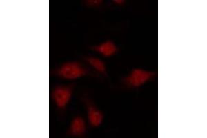 ABIN6275922 staining HepG2 by IF/ICC. (CXCR7 anticorps  (Internal Region))