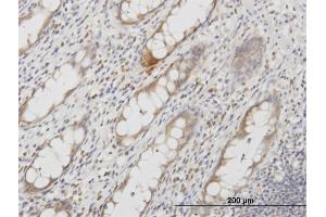 Immunoperoxidase of monoclonal antibody to AQP8 on formalin-fixed paraffin-embedded human colon.