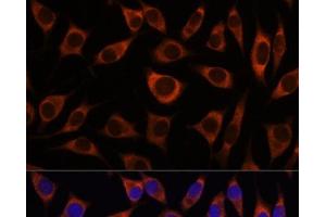 Immunofluorescence analysis of L929 cells using CTNNA3 Polyclonal Antibody at dilution of 1:100. (CTNNA3 anticorps)