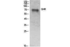 Western Blotting (WB) image for anti-Growth Hormone Receptor (GHR) (Internal Region) antibody (ABIN3178919) (Growth Hormone Receptor anticorps  (Internal Region))