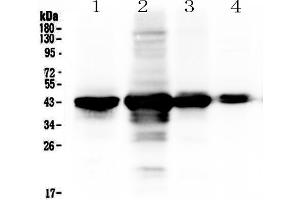Western blot analysis of PON1 using anti-PON1 antibody . (PON1 anticorps  (AA 30-274))