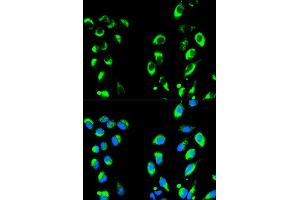 Immunofluorescence analysis of HeLa cells using NFKBIA antibody (ABIN5998339). (NFKBIA anticorps)