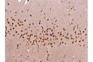 Paraformaldehyde-fixed, paraffin embedded Rat brain Antigen retrieval by boiling in sodium citrate buffer (pH6.