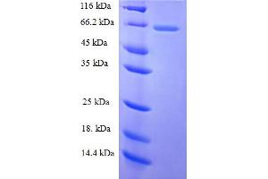 SDS-PAGE (SDS) image for Lectin, Galactoside-Binding, Soluble, 3 Binding Protein (LGALS3BP) (AA 19-574) protein (His tag) (ABIN5709845)