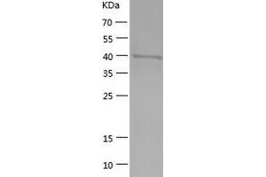 Western Blotting (WB) image for Endonuclease VIII-Like 1 (NEIL1) (AA 1-390) protein (His-IF2DI Tag) (ABIN7122773)
