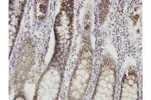 Immunoperoxidase of monoclonal antibody to DMTF1 on formalin-fixed paraffin-embedded human colon.