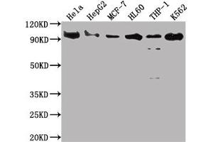 Western Blot Positive WB detected in: Hela whole cell lysate, HepG2 whole cell lysate, MCF-7 whole cell lysate, HL60 whole cell lysate, THP-1 whole cell lysate, K562 whole cell lysate All lanes: SUZ12 antibody at 1:2000 Secondary Goat polyclonal to rabbit IgG at 1/50000 dilution Predicted band size: 84 kDa Observed band size: 90 kDa (Recombinant SUZ12 anticorps)