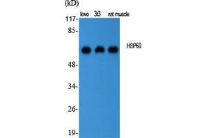 Western Blot (WB) analysis of specific cells using HSP60 Polyclonal Antibody.